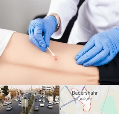 متخصص زخم بستر در باقرشهر