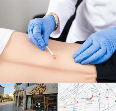 متخصص زخم بستر در عطاران قم 