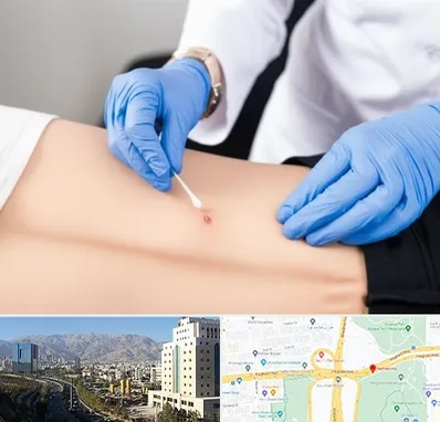 متخصص زخم بستر در حقانی