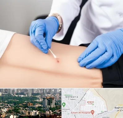 متخصص زخم بستر در عظیمیه کرج 