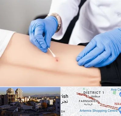 متخصص زخم بستر در فرمانیه