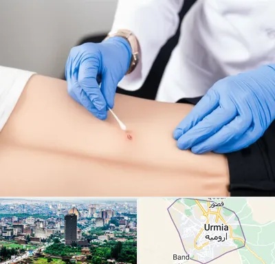 متخصص زخم بستر در ارومیه