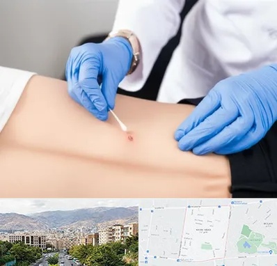 متخصص زخم بستر در خانی آباد 