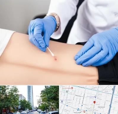 متخصص زخم بستر در امامت مشهد 