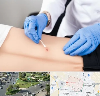 متخصص زخم بستر در شاهین ویلا کرج 