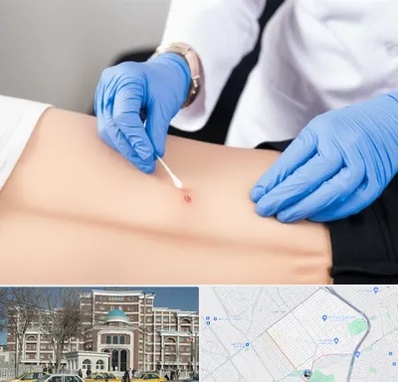 متخصص زخم بستر در طلاب مشهد 