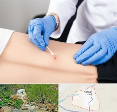متخصص زخم بستر در کردان