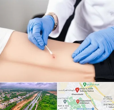 متخصص زخم بستر در قصرالدشت شیراز 