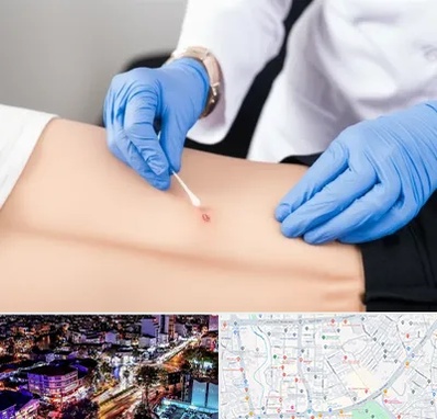 متخصص زخم بستر در منظریه رشت 