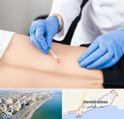 متخصص زخم بستر در بندرعباس