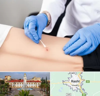 متخصص زخم بستر در رشت