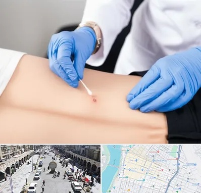 متخصص زخم بستر در نادری اهواز 