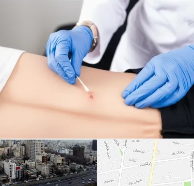 متخصص زخم بستر در زرتشت