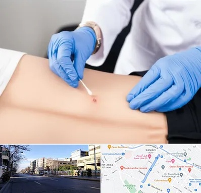 متخصص زخم بستر در خیابان ملاصدرا شیراز 