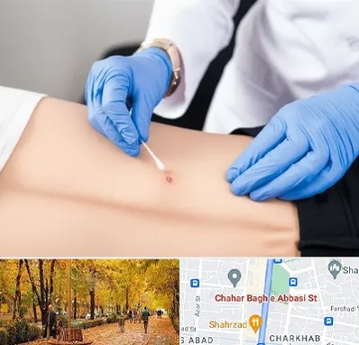 متخصص زخم بستر در چهارباغ اصفهان 