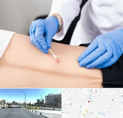 متخصص زخم بستر در بلوار کلاهدوز مشهد 