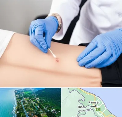متخصص زخم بستر در رامسر