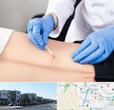 متخصص زخم بستر در شریعتی مشهد 