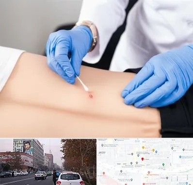 متخصص زخم بستر در کارگر شمالی