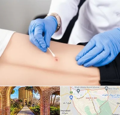 متخصص زخم بستر در شهر ری