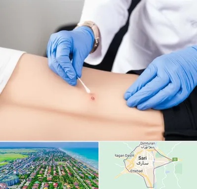 متخصص زخم بستر در ساری