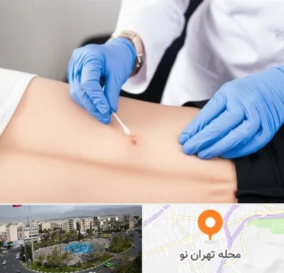 متخصص زخم بستر در تهران نو