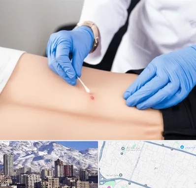 متخصص زخم بستر در ازگل 