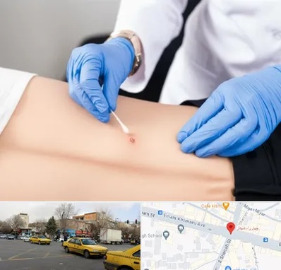 متخصص زخم بستر در شهناز تبریز 