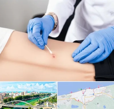 متخصص زخم بستر در بابلسر