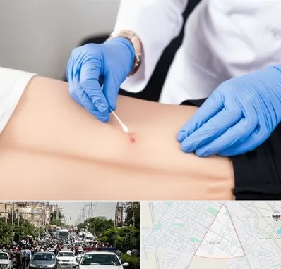 متخصص زخم بستر در سیدی مشهد 