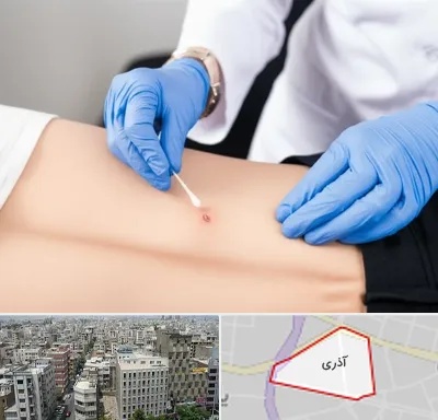 متخصص زخم بستر در آذری