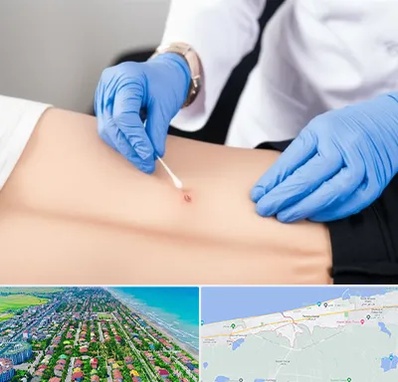 متخصص زخم بستر در فریدونکنار