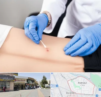 متخصص زخم بستر در پرواز تبریز 