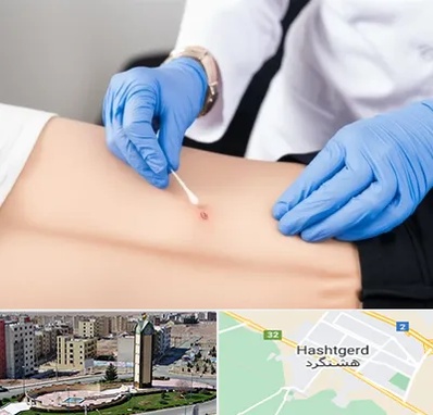 متخصص زخم بستر در هشتگرد