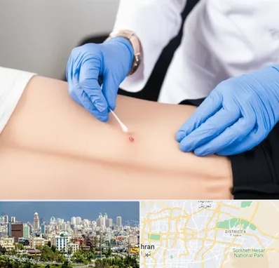 متخصص زخم بستر در شرق تهران 