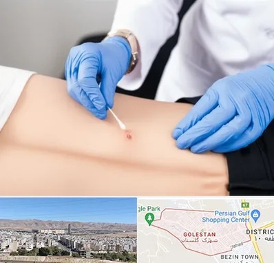 متخصص زخم بستر در شهرک گلستان شیراز 