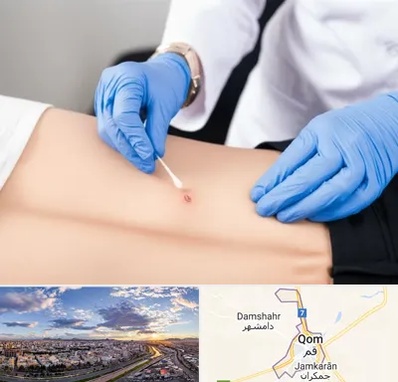 متخصص زخم بستر در قم