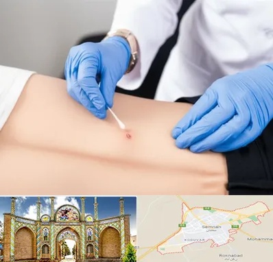 متخصص زخم بستر در سمنان