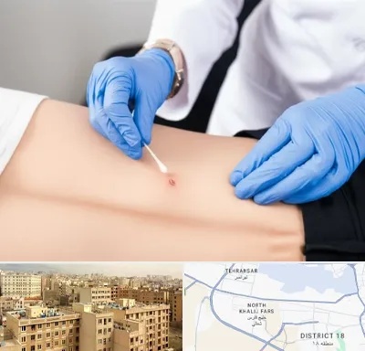 متخصص زخم بستر در جنوب غرب تهران