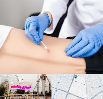 متخصص زخم بستر در پادادشهر اهواز 