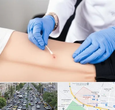 متخصص زخم بستر در گلشهر کرج 