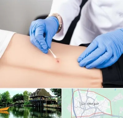 متخصص زخم بستر در صومعه سرا