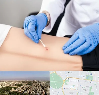 متخصص زخم بستر در نازی آباد 