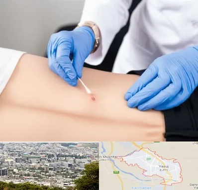 متخصص زخم بستر در یاسوج