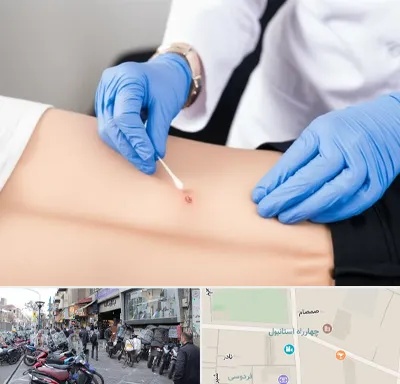 متخصص زخم بستر در چهارراه استانبول