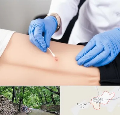 متخصص زخم بستر در شاندیز مشهد 