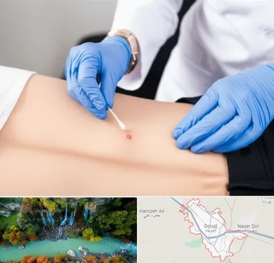 متخصص زخم بستر در دورود