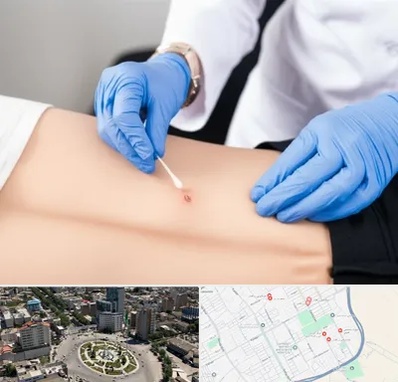 متخصص زخم بستر در زرافشان اسلامشهر 