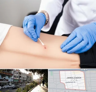 متخصص زخم بستر در خیابان جمالزاده