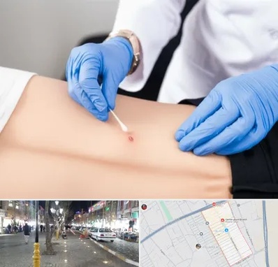 متخصص زخم بستر در باغ فیض اسلامشهر 